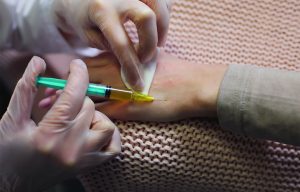Hydo Injection Into Hand Hand Arthritis Injections In Dubai - Dr. Robert Hiener