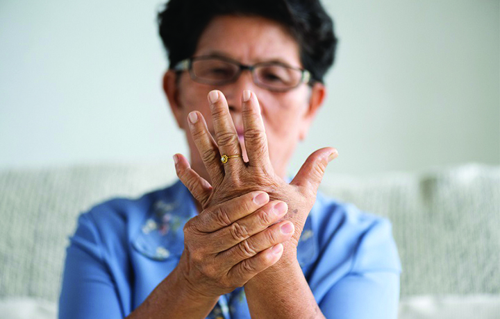 Rheumatoid arthritis treatment in Dubai