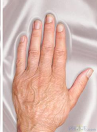 aging hand 3
