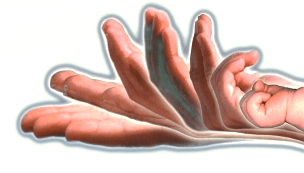 hand condition 1 1024x584 1