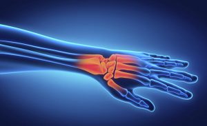 Blog 22 hand injury xray pain