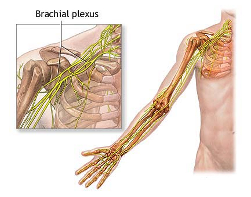 Brachial Plexus Lesions