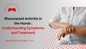 hand arthritis symptoms rheumatoid